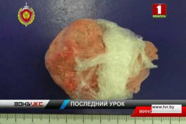 Ссылки на сайты в даркнете